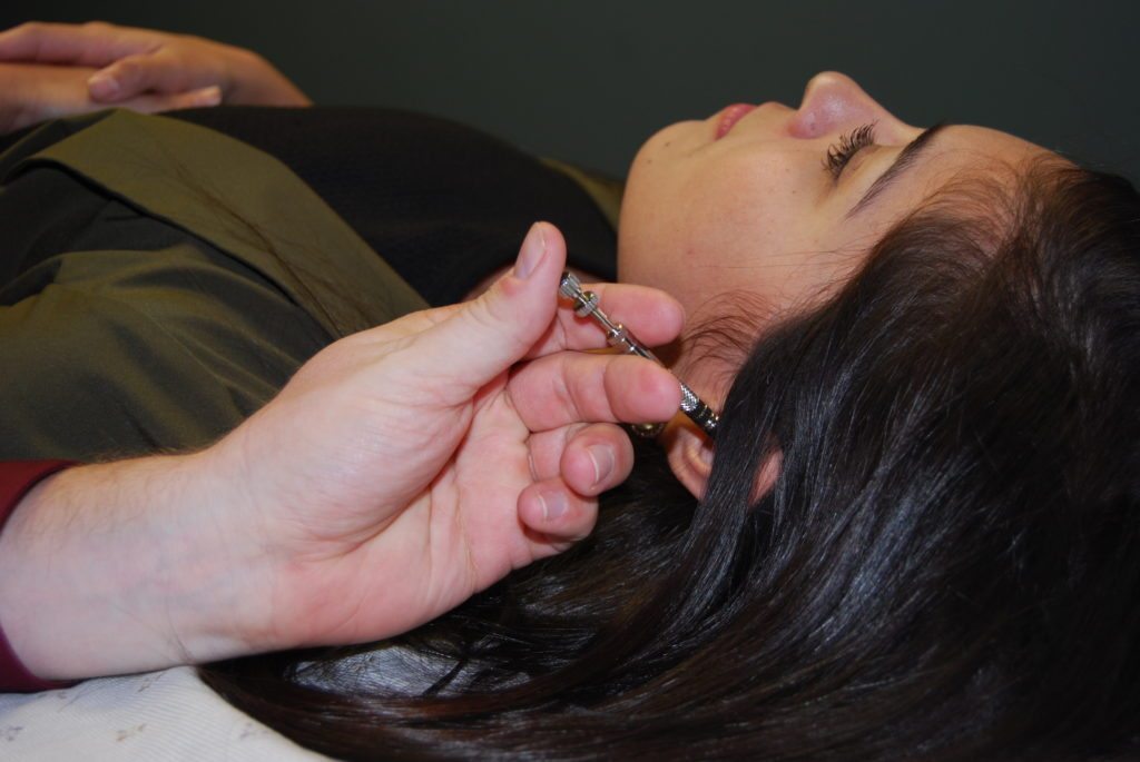 Dr. Reece Hayden Performs Acupuncture for Pain Relief fibromyalgia