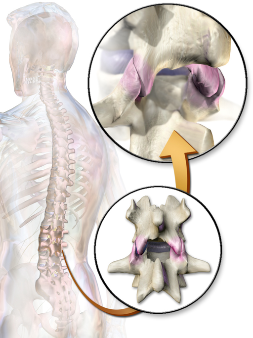 spinal facet joints