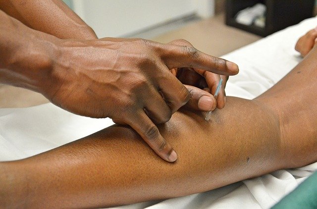 dry needling in the lower leg - acupuncture